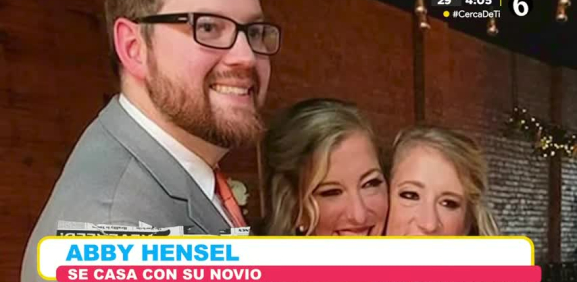 Famosas siamesas Abby y Brittany Hensel se casan y esto se hace viral.