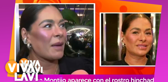 Galilea Montijo aparece con el rostro hinchado y recibe criticas