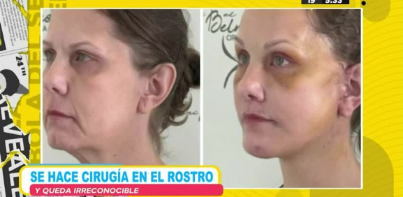 Le quitaron más de 20 años a esta señora