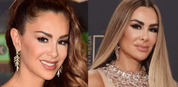Ninel Conde: el antes y después de sus cirugías