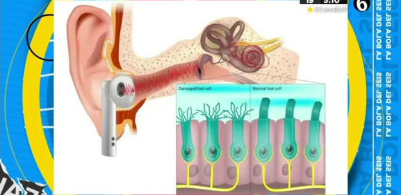 Conoce más sobre el termino pabellón auricular