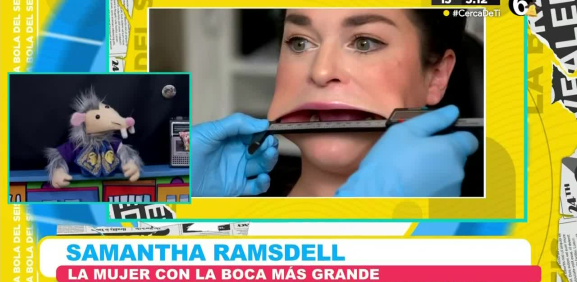 Samantha Ramsdell rompe el récord como la mujer con la boca más grande