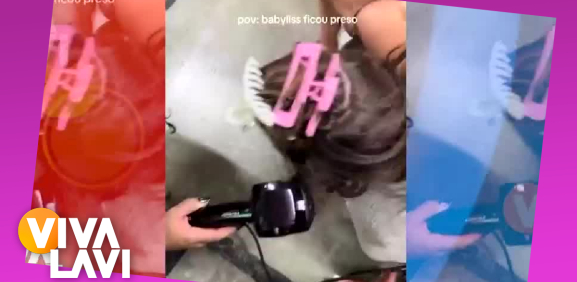 Mujer casi pierde su cabello por culpa de rizadora