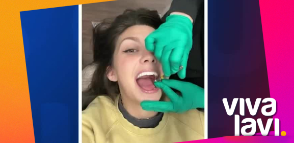 Joven se quita todos los dientes para ponerse dentadura falsa