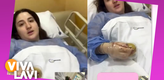 Joven casi pierde una mano por 'lavar' los platos