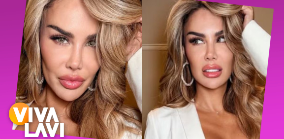 Ninel Conde se somete a cirugía para cambiarse el color de ojos
