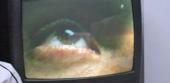 Crean ojo robótico que ayuda a recuperar la vista