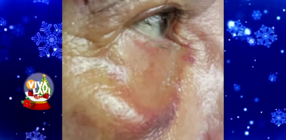 Juan José Origel sufre aparatoza caída