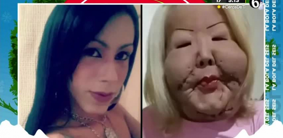 Juju Do Pix, esta chica se sometió a un proceso ilegal estético y el resultado fue fatal para su piel