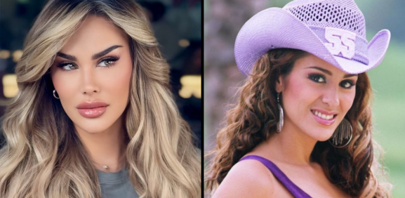 Así se veían las famosas antes de sus cirugías estéticas