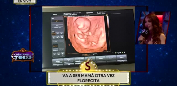 La ex chica de 'Es Show' confirma estar embarazada y por eso motivo dejar el programa