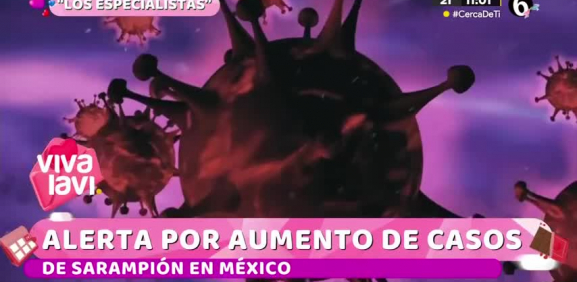 Todo lo que debes saber sobre el Sarampión