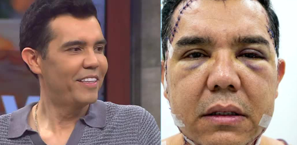 ¿Qué le pasó a Ángel Castro?