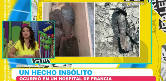 Este caso en Francia alarmó a la medicina mundial tras conocer donde tenía un arma de guerra