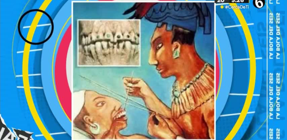 Según estudios se comprueba que los pueblos mayas se quitaban las caries y tenían una cultura de limpieza dental