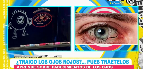 Con 'bolitas y palitos' te explicamos esta popular manera de hablarle a esta afección a los ojos