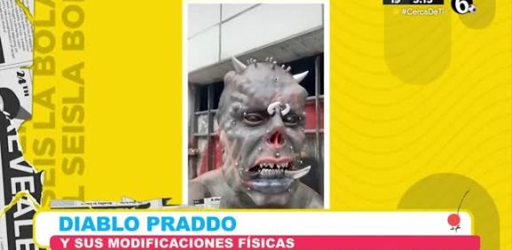 Un tatuador brasilero de 44 años decidió realizarse una intervención brutal