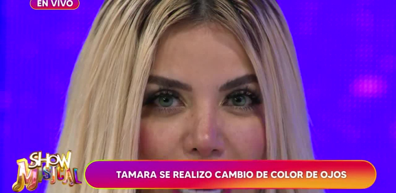 La conductora de 'Es Show el musical' sorprende al cambiarse el color de sus ojos con riesgosa operación