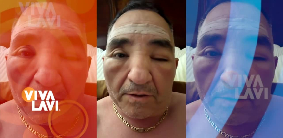 Enesto Chavana aparece irreconocible en redes sociales