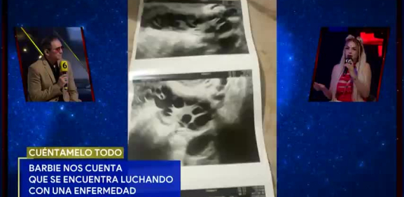 La chica de 'Es Show' revela que padece de 'síndrome de ovario poliquístico' y la tiene muy atormentada