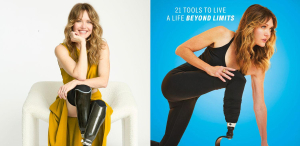 Amy Purdy y su historia de superación