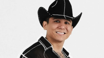 Edwin Luna sorprende con radical cambio tras realizarse procedimiento estético