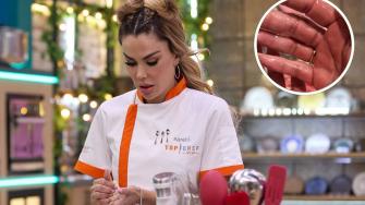Ninel Conde sufre grave quemadura en ‘Top Chef VIP 2026’