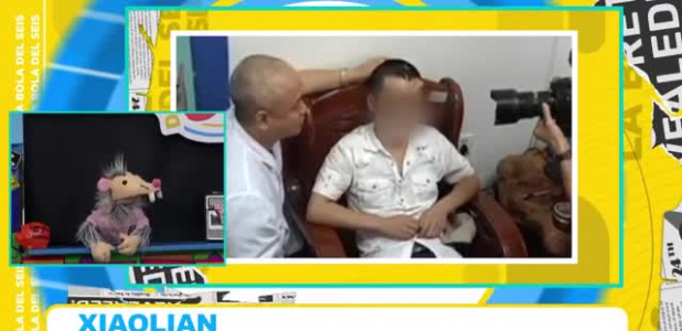 Injertan nariz en su frente por este raro motivo