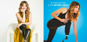 Amy Purdy y su historia de superación