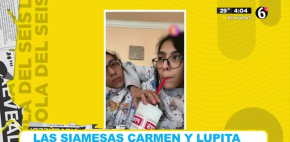 Las siamesas Carmen y Lupita habla de su vida amorosa