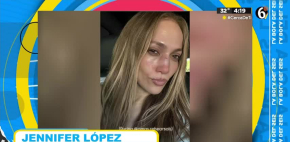 Jennifer Lopez sufre una aparatosa caída y se rompe la nariz