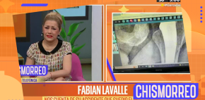 Así fue el accidente de Fabián Lavalle
