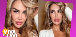 Ninel Conde se somete a cirugía para cambiarse el color de ojos