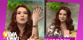 Alexia Almeida rompe el silencio sobre su vitiligo