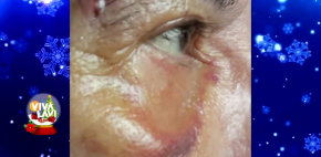 Juan José Origel sufre aparatoza caída