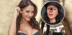 Dorismar revela mala praxis tras someterse a cirugía estética