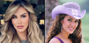 Así se veían las famosas antes de sus cirugías estéticas