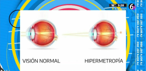 Conoce los diferentes padecimientos de la vista y sus diferencias