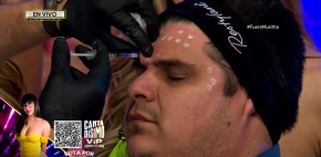 Le inyectan botox a Lalo Elizondo y este fue el resultado