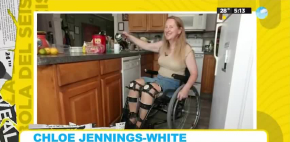 Chloe Jennings-White, la científica que busca la amputación de sus piernas