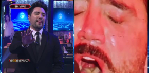 Alejandro Fernández ¿tiene la lengua amarilla?