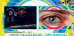 ¿Qué son las 'perrillas' en los ojos?