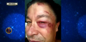 El TunTun recibió un fuerte golpe de calor