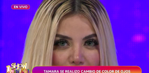 Tamara se somete a operación para cambiarse el color de sus ojos