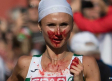 Ganadora del Maratón de Berlín termina llena de sangre