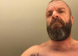 Triple H comparte foto de la lesión que sufrió en Arabia Saudita