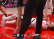 Portland pierde a Jusuf Nurkic en una de las peores lesiones en la historia de la NBA