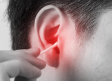 ¿Usas cotonetes para limpiar tus oídos? Esto es lo que podría pasarte