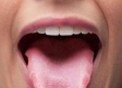 Maneras de detectar su tienes Virus del Papiloma Humano con tu saliva