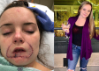 A dos años de que su ‘novio’ le arrancara el labio de una mordida, Kayla Hayes ha recuperado su vida y su seguridad